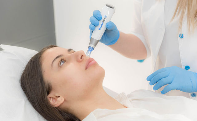 Dermapen 4 – soluția perfecta pentru rezolvarea problemelor inestetice ale pielii
