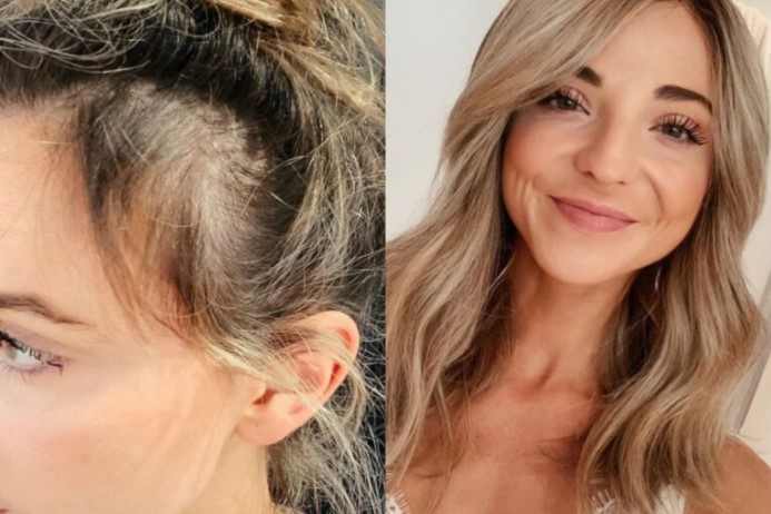 Tipuri de alimente perfecte pentru creșterea părului