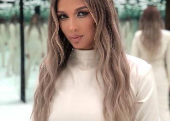 Transformare incredibilă! Așa arăta Lora înaintea operațiilor estetice! Este de nerecunoscut ..