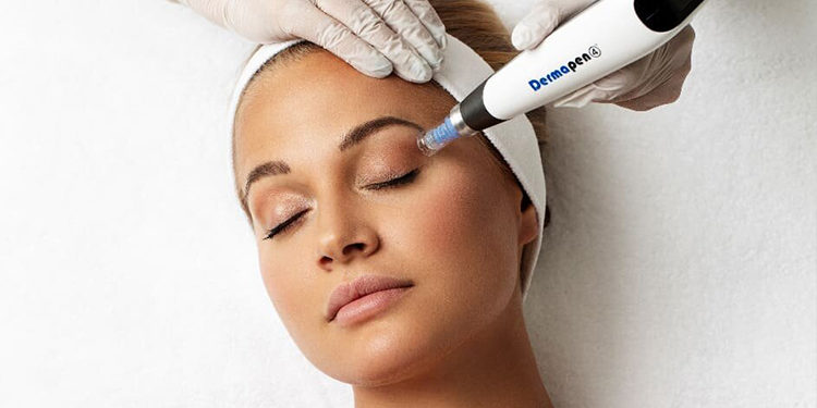 Tratament cu Dermapen: secretul unui ten radiant