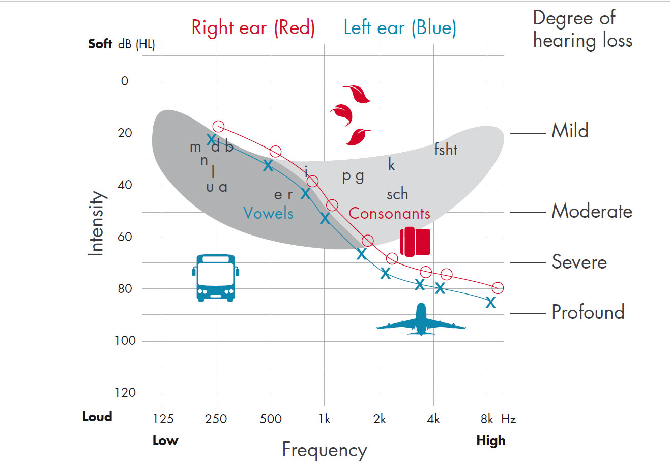 Informatii utile despre audiograma. Afla mai multe de la specialisti