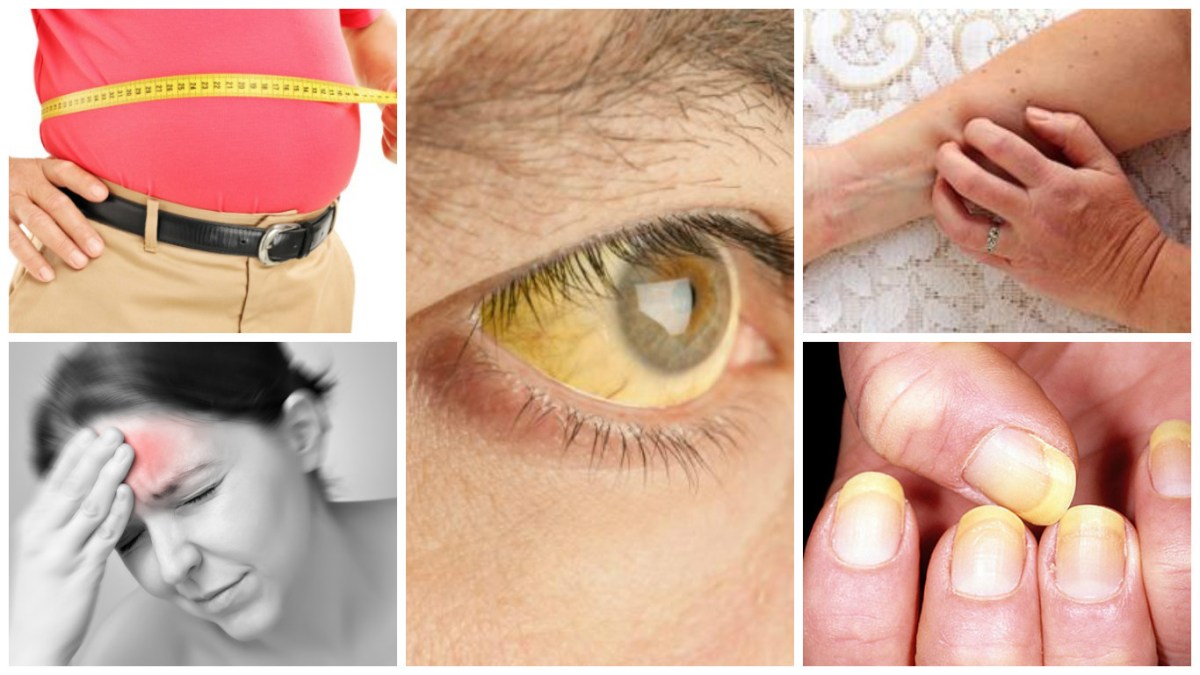 Cum îți dai seama că ai ficatul bolnav.