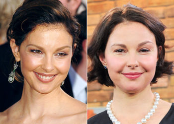 Operațiile estetice au distrus-o.