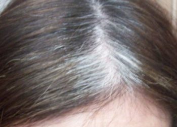 Ţi-a albit părul prea devreme?