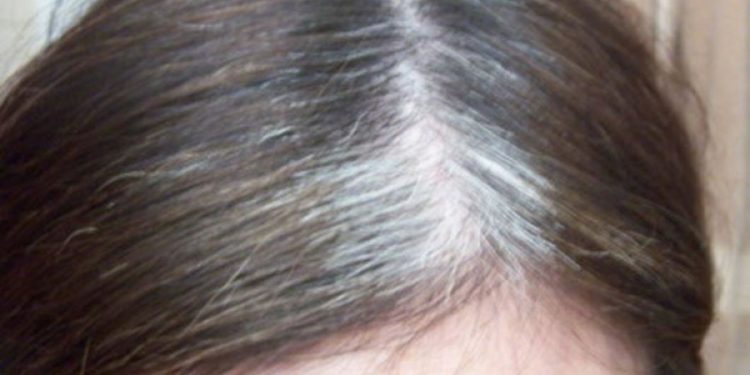 Ţi-a albit părul prea devreme?