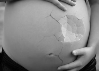 Medici din toată țara refuză să mai facă avorturi în Postul Paștelui