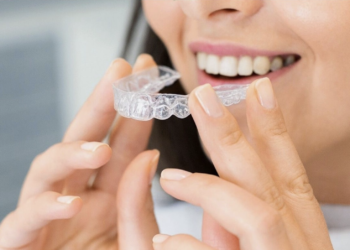 Aparat dentar care nu se vede? Află totul despre el