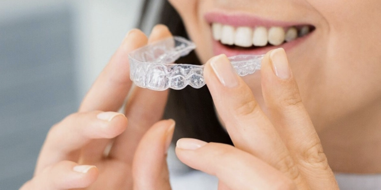 Aparat dentar care nu se vede? Află totul despre el