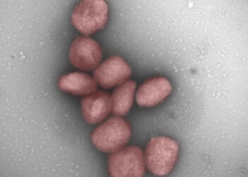 Un studiu CSIC indică posibilitatea ca variola maimuțelor să fie transmisă prin aer