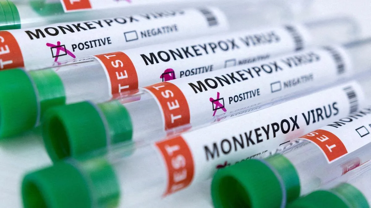 OMS schimbă numele monkeypox în „pox”