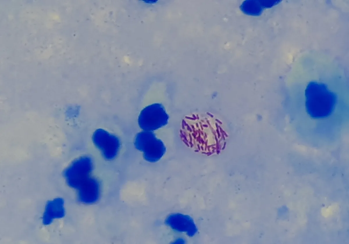Bacteria lepră este capabilă să regenereze organele