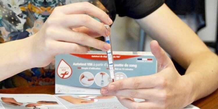 Numărul diagnosticelor tardive HIV rămâne "îngrijorător de mare"