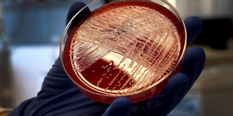 Doi minori mor la Madrid și alți 14 sunt tratați pentru streptococ A