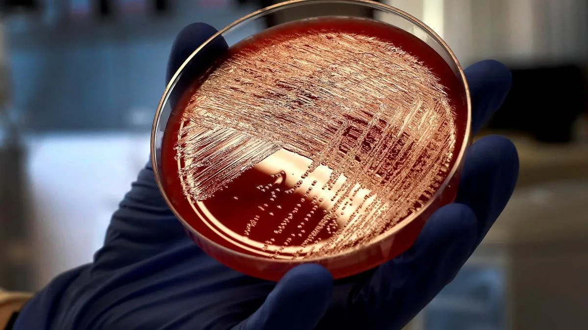 Madrid înregistrează 24 de cazuri de boală invazivă datorată streptococului A