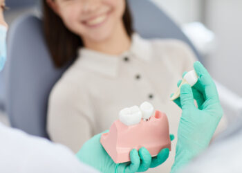 4 întrebări importante de adresat medicului înainte de operația de implant dentar