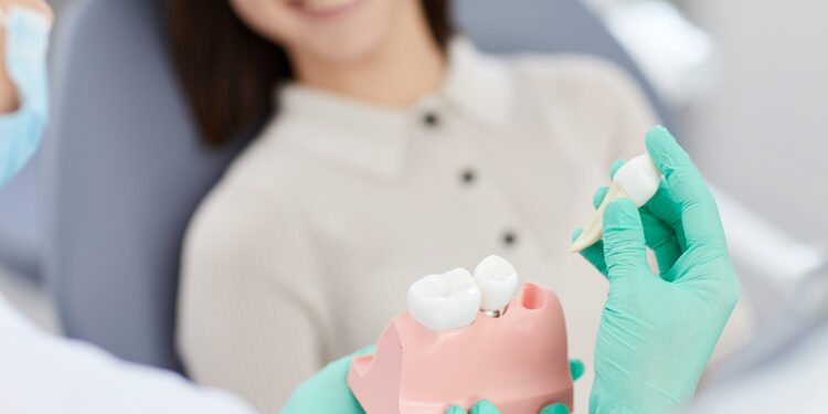 4 întrebări importante de adresat medicului înainte de operația de implant dentar