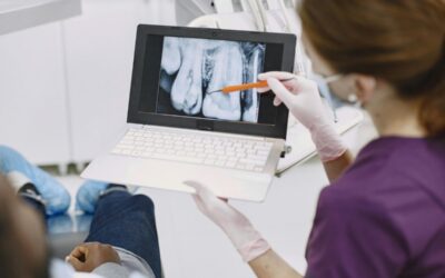 Implant dentar Straumann: ce se întâmplă în lunile dintre inserare și lucrarea finală